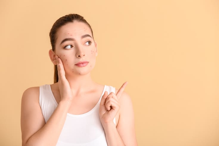 🧴 Skincare Mistakes You Should Avoid